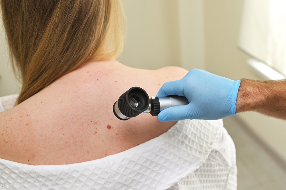 A dermatologist oncologist uses a dermatoscope to examine moles.